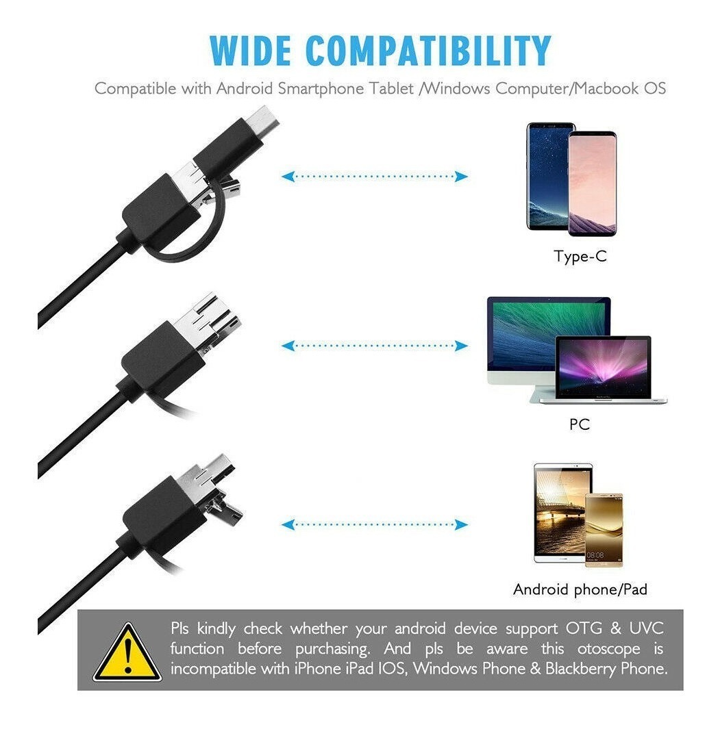 Removedor De Cera Para Oídos Endoscopio - Imagen 3