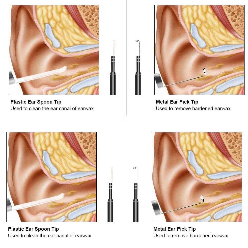 Removedor De Cera Para Oídos Endoscopio - Imagen 4