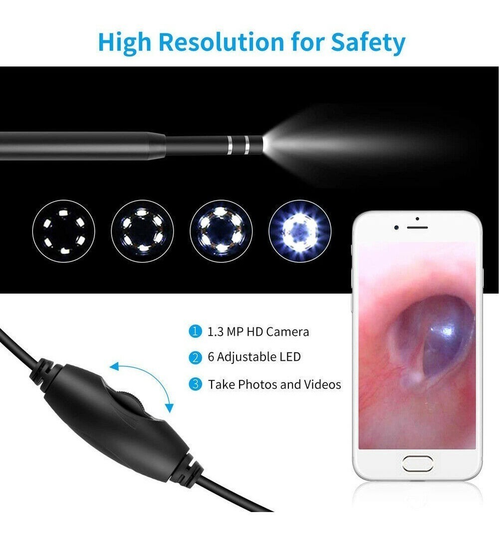 Removedor De Cera Para Oídos Endoscopio - Imagen 5